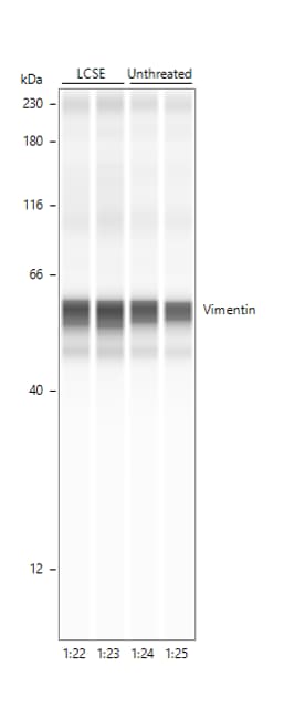 Human/Mouse/Rat Vimentin Antibody AF2105
