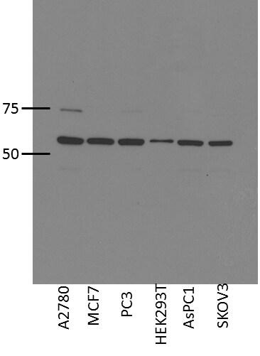 CBARA1 Antibody - BSA Free NBP1-86663