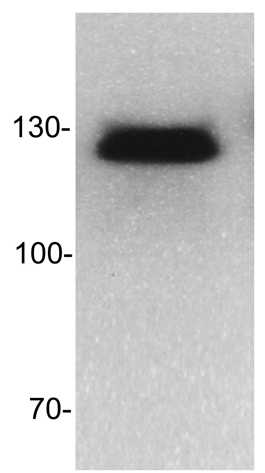 DNMT3B Antibody NB300-516