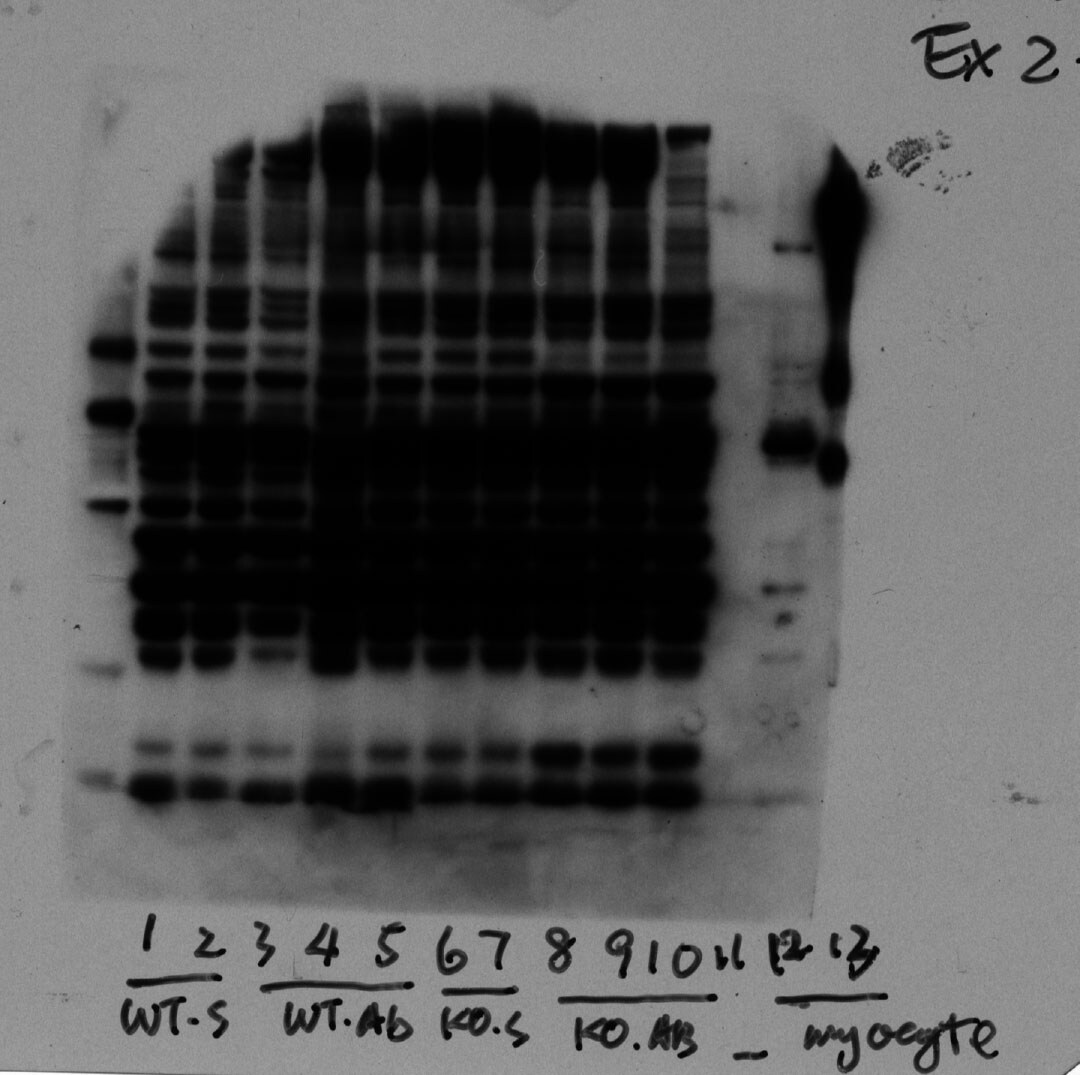 LC3 Antibody Pack NB910-40435
