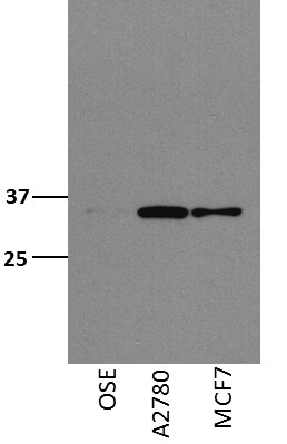 SMNDC1 Antibody - BSA Free NBP1-47302