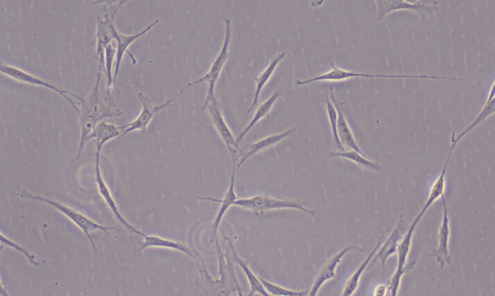 Human Wnt‑16b Antibody MAB7790