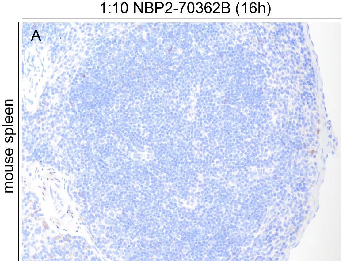 CD20 Antibody (OTI4B4) [Biotin] NBP2-70362B