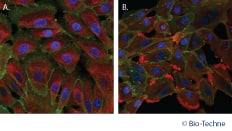 Human Mammary Epithelial Cells (HMECs) Express Mammary Epithelial Cell Markers Cytokeratin 14, Cytokeratin 18, and E-Cadherin