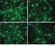 CDK011 Data Examples