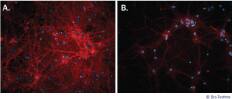 More Robust Synaptic Puncta Development for Primary Rat Cortical Neurons Cultured using NeuroXVivo Rat Cortical Neuron Culture Kit.