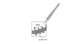 Remove spinal cord adjacent tissue to expose the DRGs