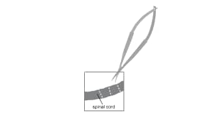 Collect isolated spinal cords and transfer into a petri dish containing ice-cold L-15 Media