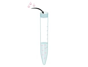 Isolate mouse splenocytes