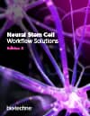 Neural Stem Cells