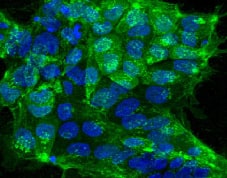 NLLC16581G TRA-1-81 Example Data