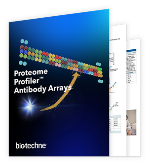 Proteome Profiler Antibody Arrays