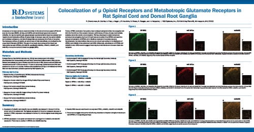 Colocalization of μ Opioid Receptors and Metabotropic Glutamate Receptors Poster Thumbnail
