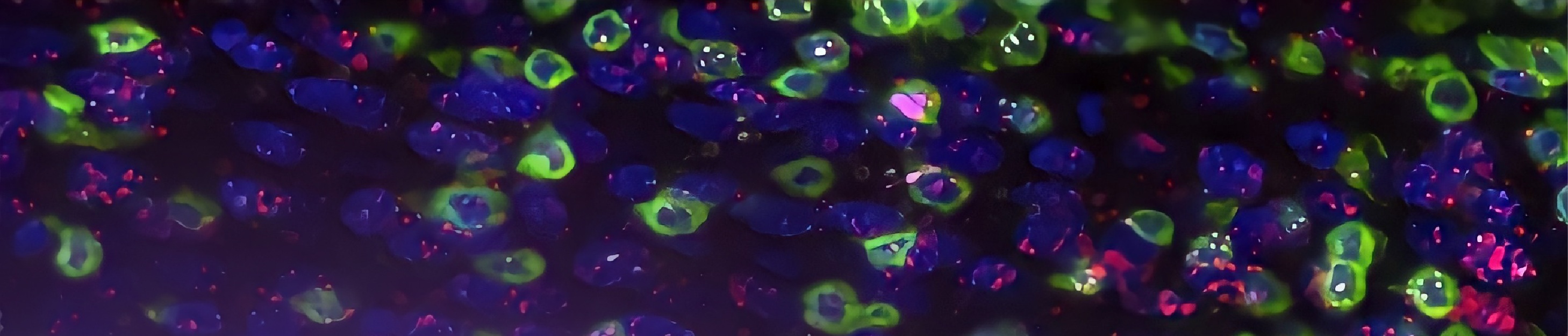 Dual ISH-IHC: Better Together thumb