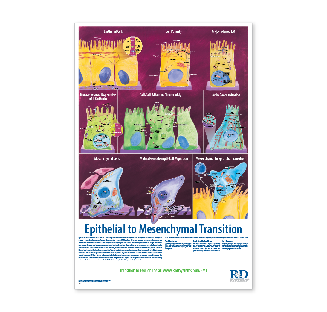 Epithelial to Mesenchymal Transition Poster