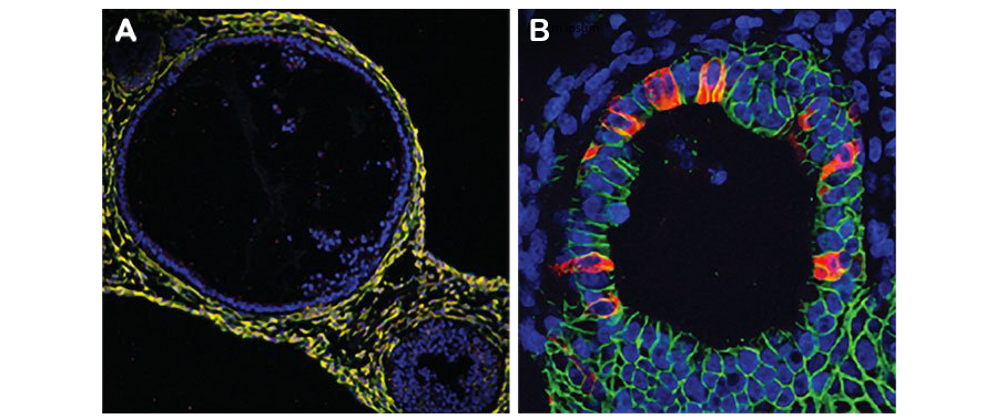 Culture and Characterization of iPSC-derived Human Intestinal Organoids
