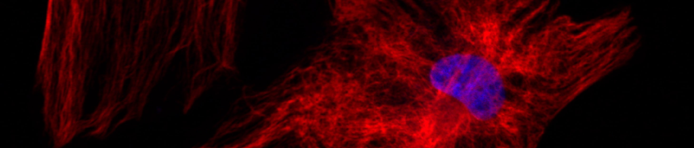 Neuroscience Research Review: Neuronal EphB1 Activates a Neuroprotective Astrocyte Phenotype Banner