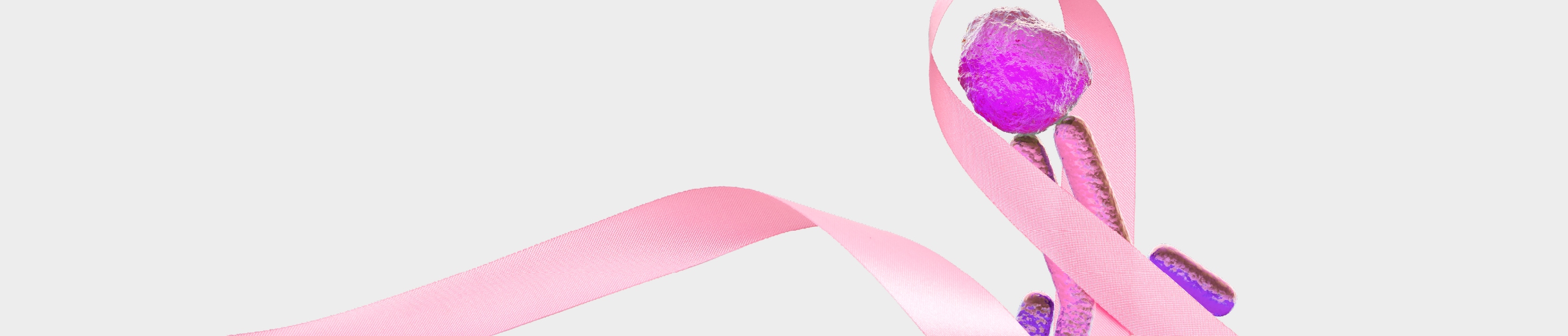 NPC1: A Potential Target For Triple-Negative Breast Cancer thumb