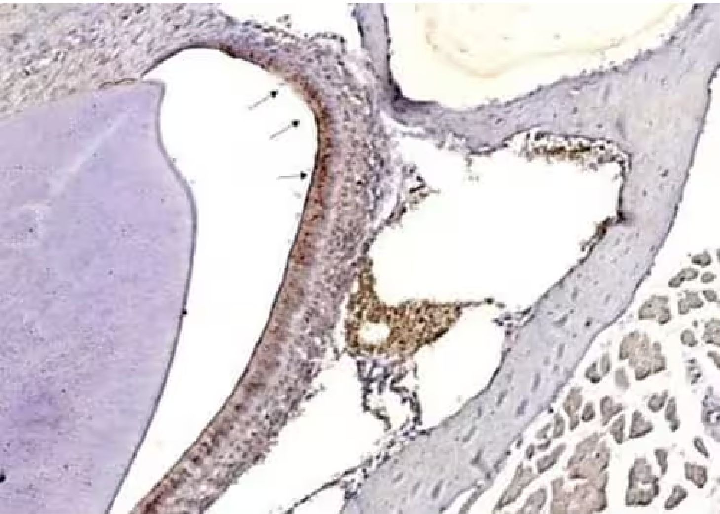 IHC detection of Influenza A H3N2 Hemagglutinin (HA) protein in infected mouse nasal tissue.