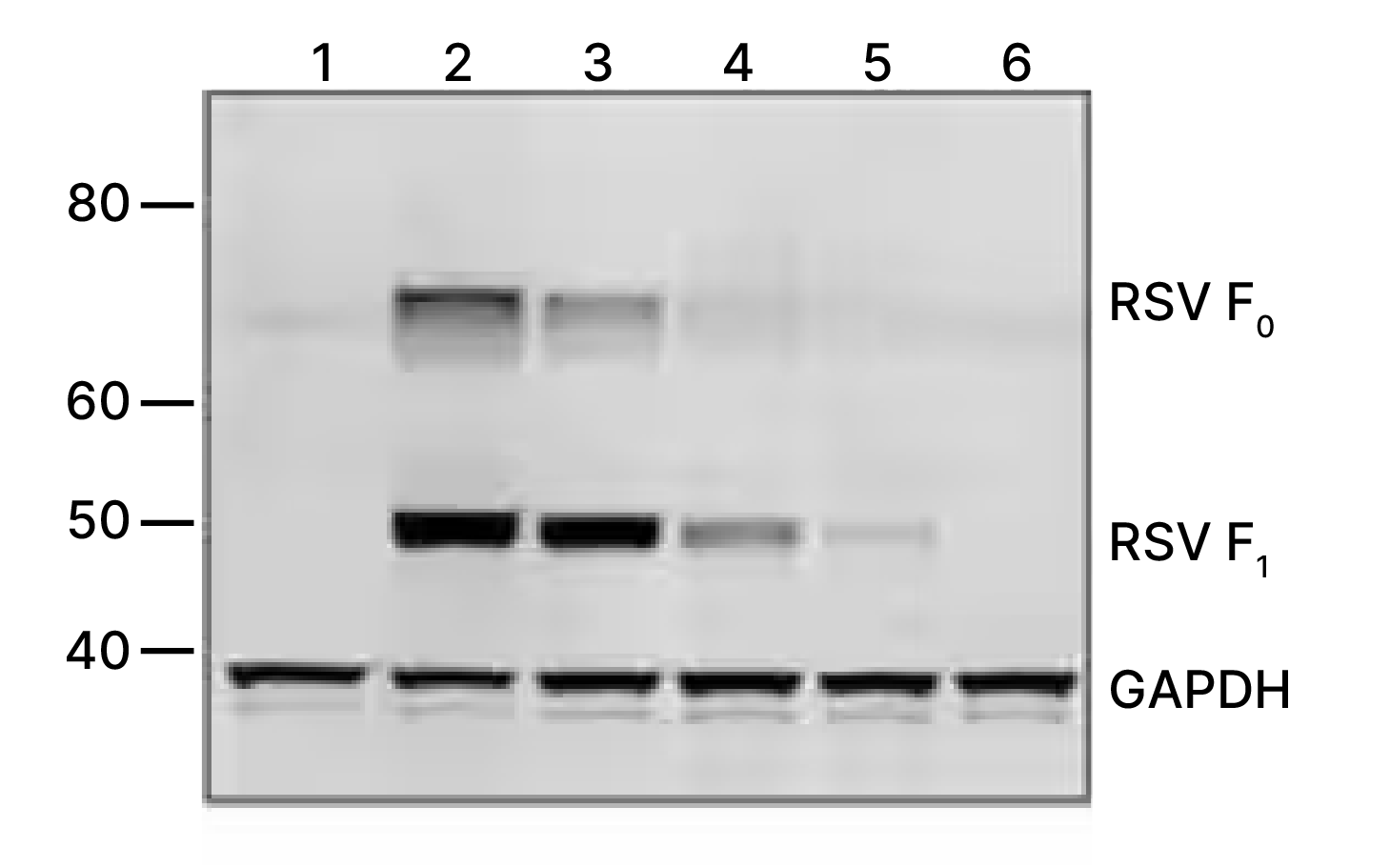 WB analysis of RSV expression in lysates of infected cells.