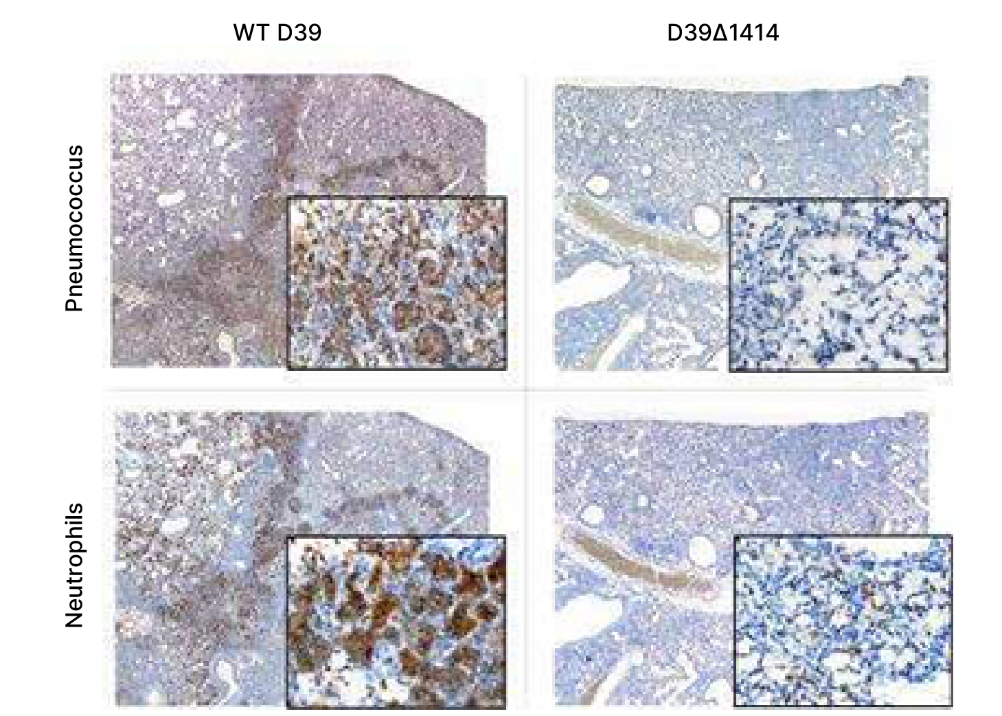 IHC analysis of post-infection lung sections from mice co-infected with Influenza A and Type 2 Pneumococcal strain D39 variants.
