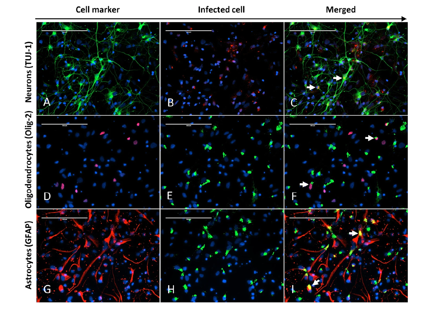 IF analysis of Newcastle Disease Virus antibody expression and cell markers in infected chicken neural cells.