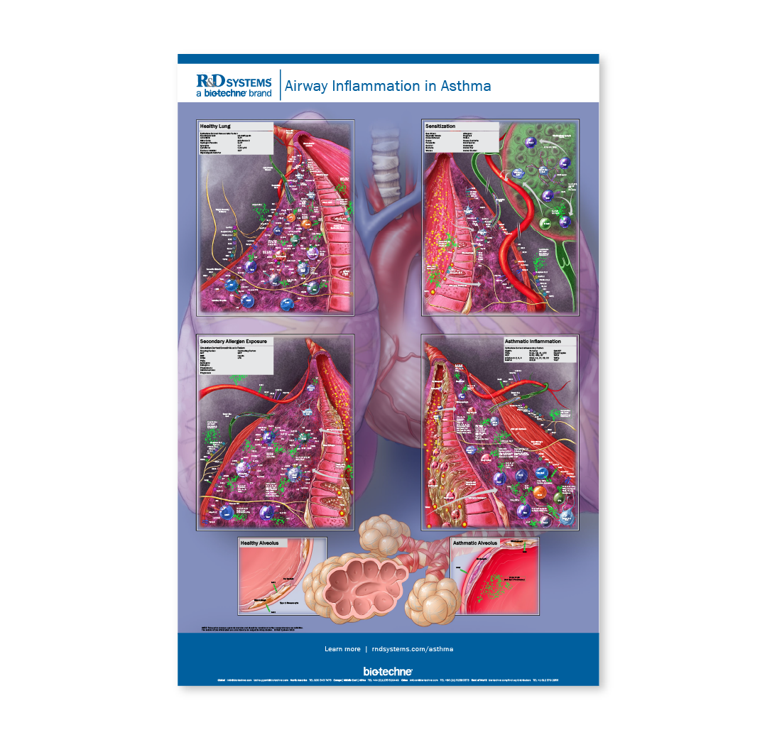 Airway Inflammation In Asthma Poster