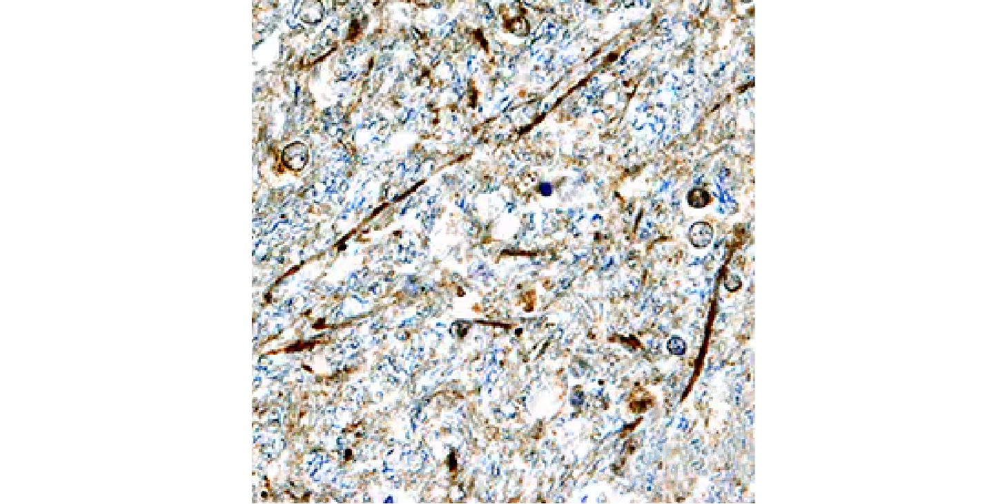 Goat Anti-Human alpha -Synuclein Antigen Affinity-purified Polyclonal Antibody figure