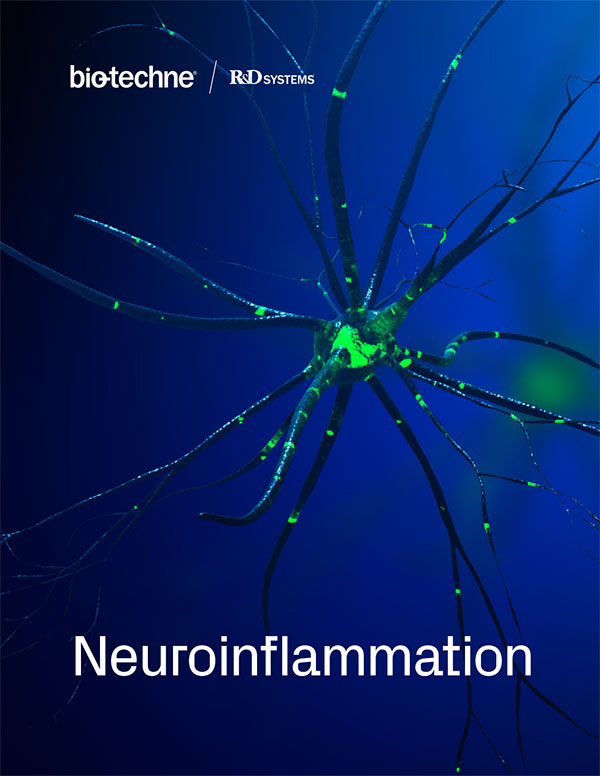 Neuroinflammation