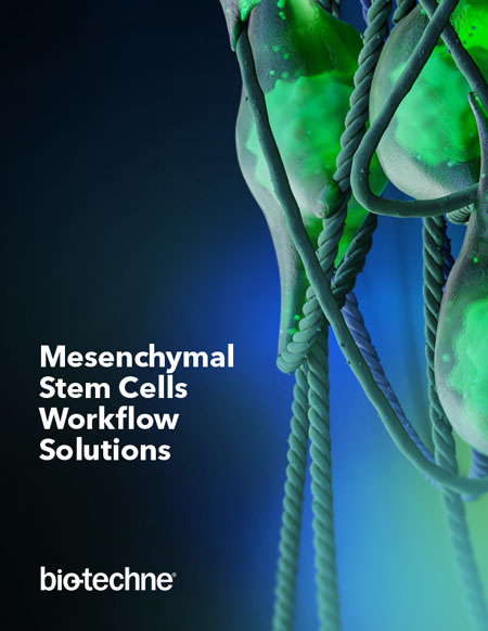 Mesenchymal Stem Cells